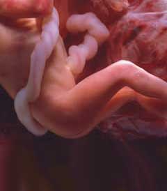 feto en su vigésima séptima y vigésima octava semana de gestación