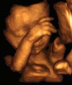 feto en su vegésima novena y treintava semana de gestación