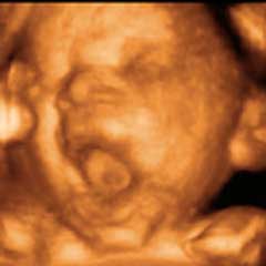 feto en su treintava séptima a cuarentava semana de gestación