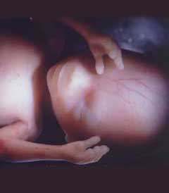 feto en su decimoséptima y decimoctava semana de gestación